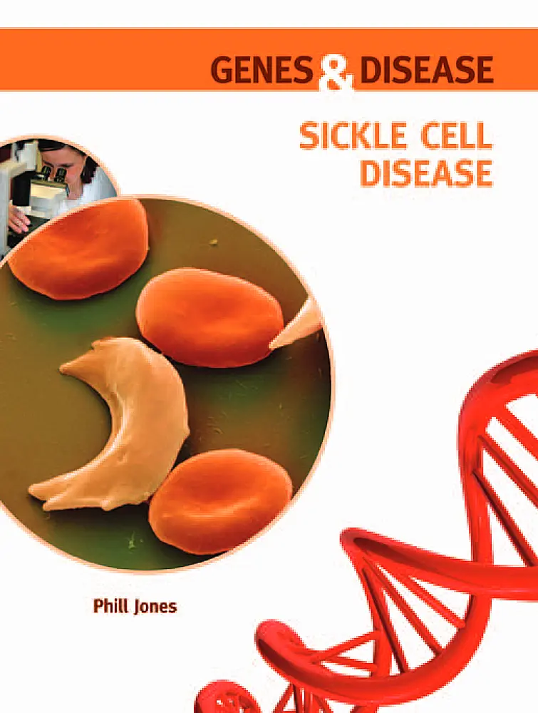 Sickle Cell Disease (Genes and Disease) by Phill Jones